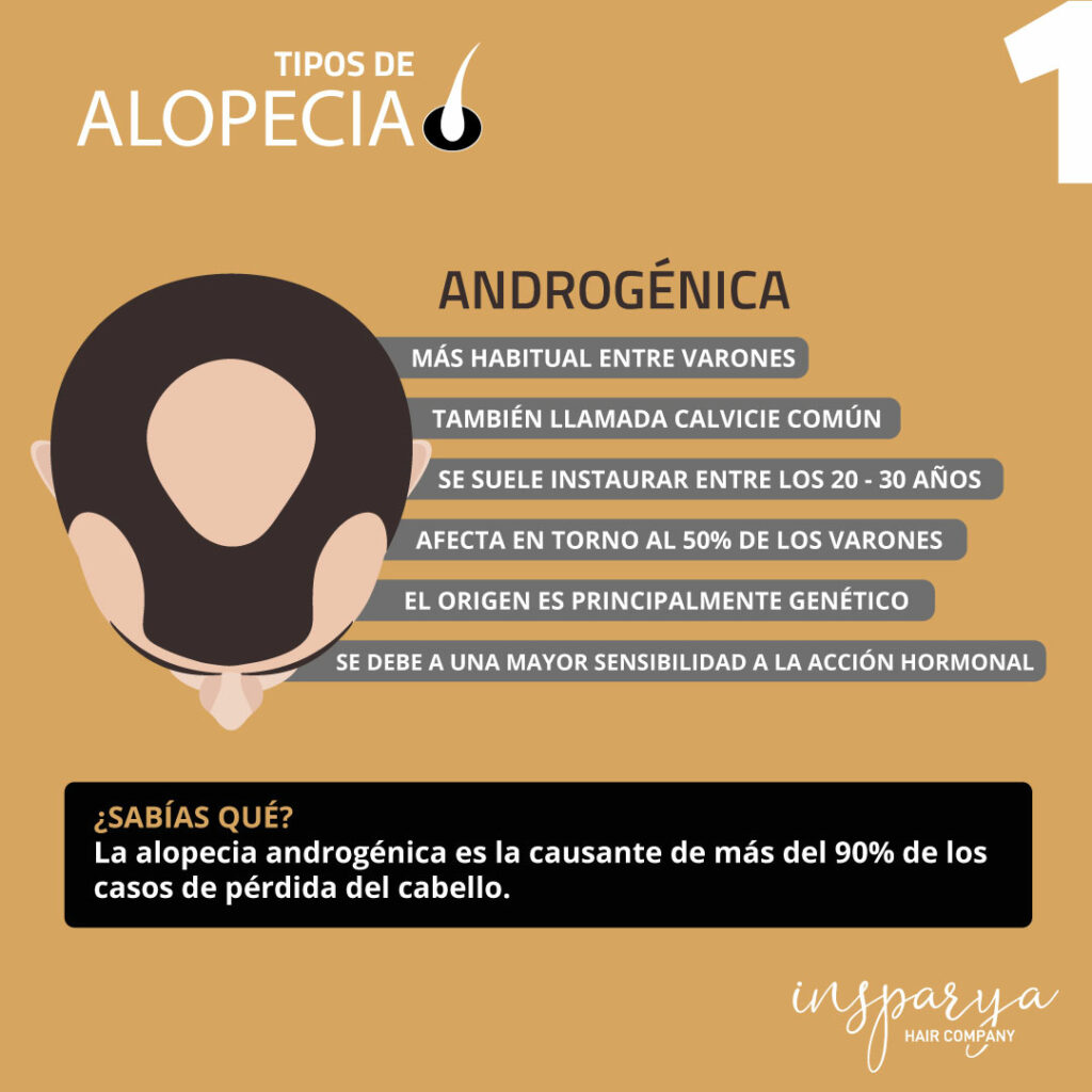 alopecia androgenÃ©tica