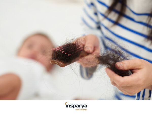 Caída de pelo postparto: causas, duración y tratamientos para recuperar tu cabello Caída de pelo postparto: causas, duración y tratamientos para recuperar tu cabello
