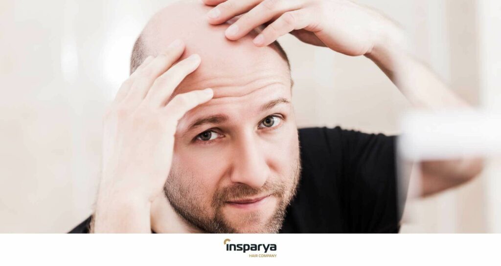 Relación entre la alopecia y salud bucodental
