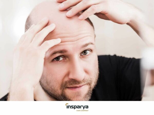 Relación entre la alopecia y salud bucodental