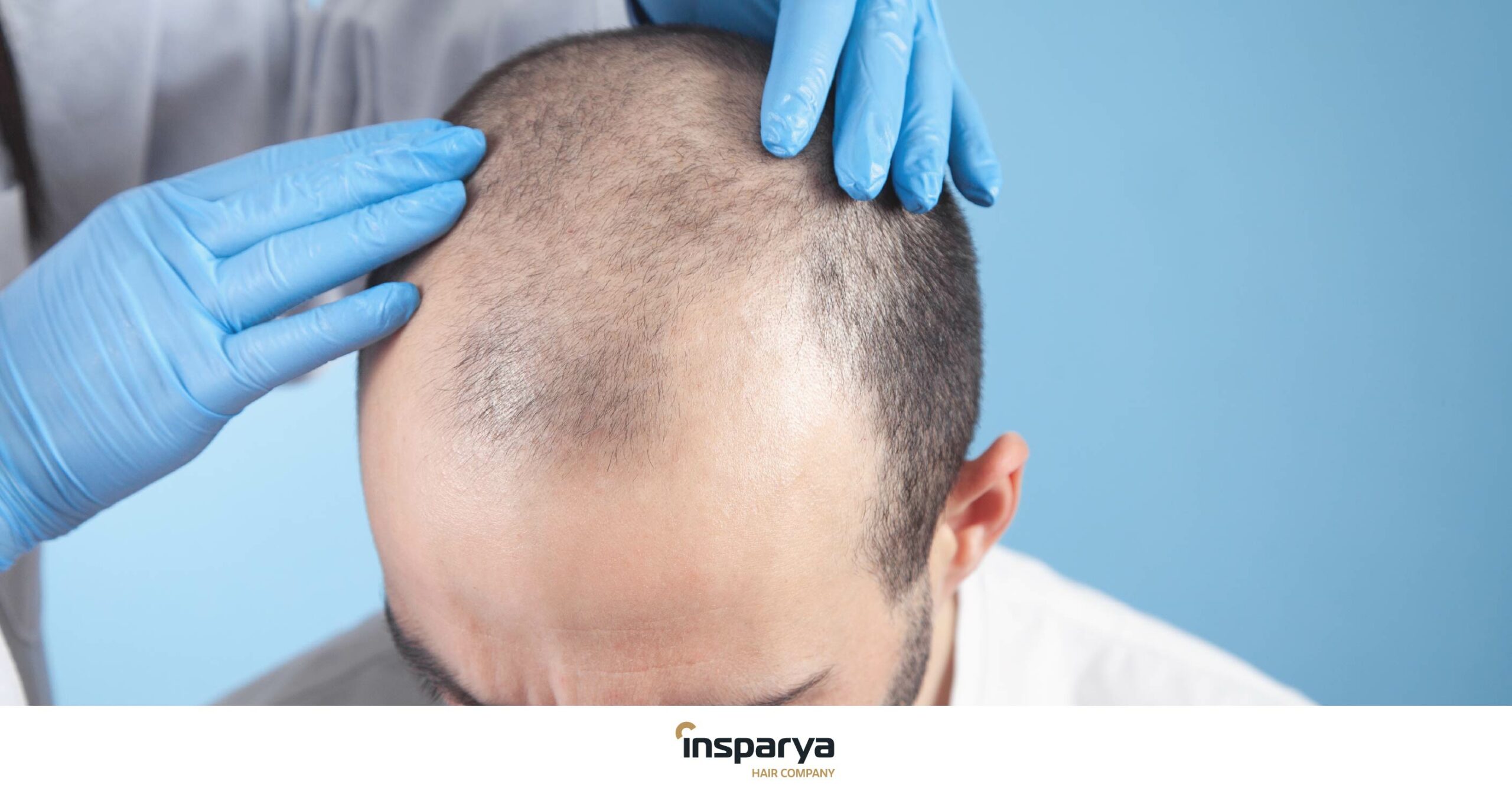 What expectations can we have with a hair transplant?