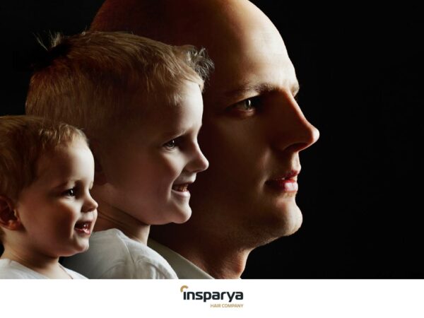 Alopecia at different stages of life