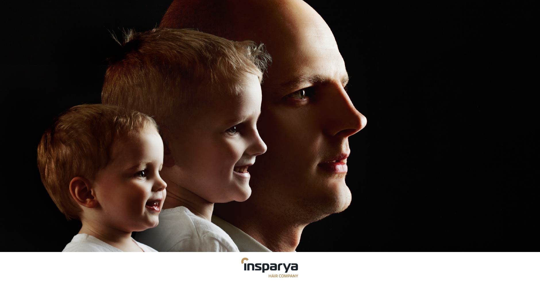 Alopecia at different stages of life