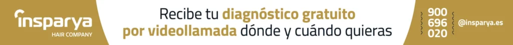 Minoxidil: qué es, para qué sirve y cómo usarlo para el pelo y la barba Minoxidil: qué es, para qué sirve y cómo usarlo para el pelo y la barba