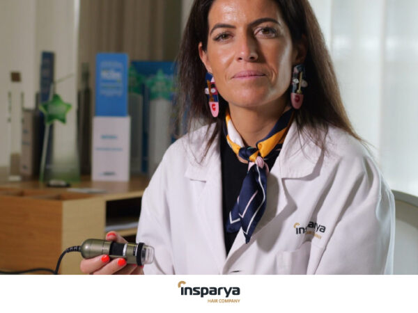 La relación entre la calvicie y el riesgo de melanoma