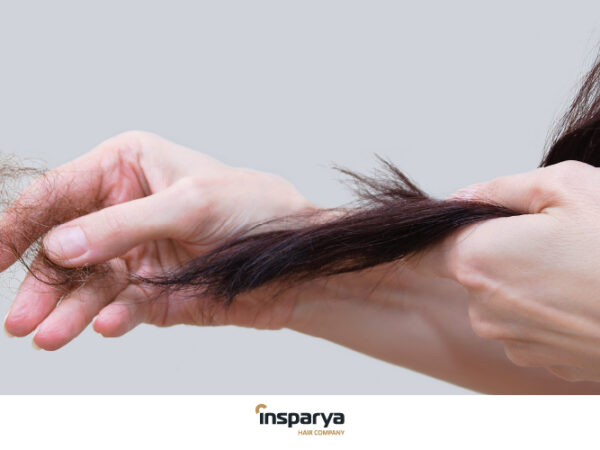 Caída de pelo en mujeres: causas, tratamientos y cuándo preocuparse