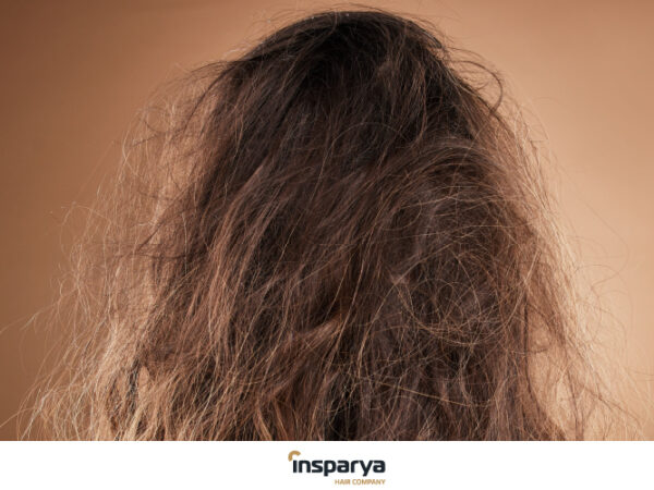 Pelo quemado por el sol, el verano nos ha pasado factura