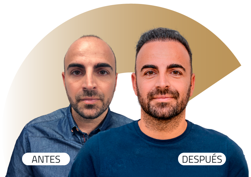 Insparya Antes / Despues