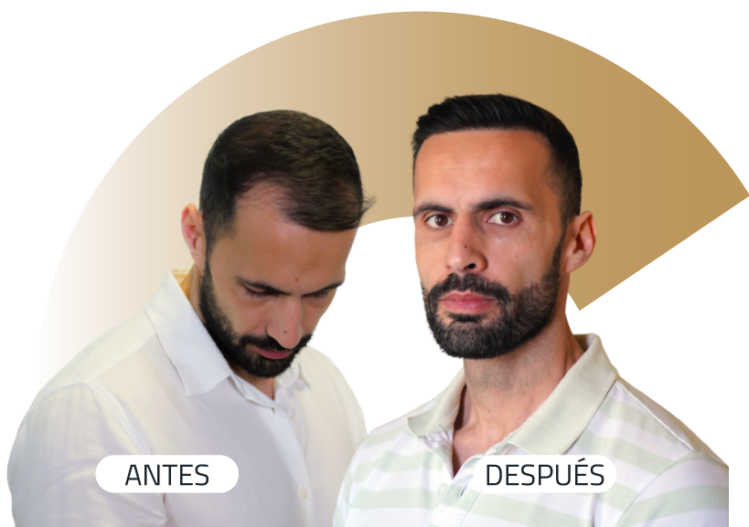 Insparya Antes / Despues