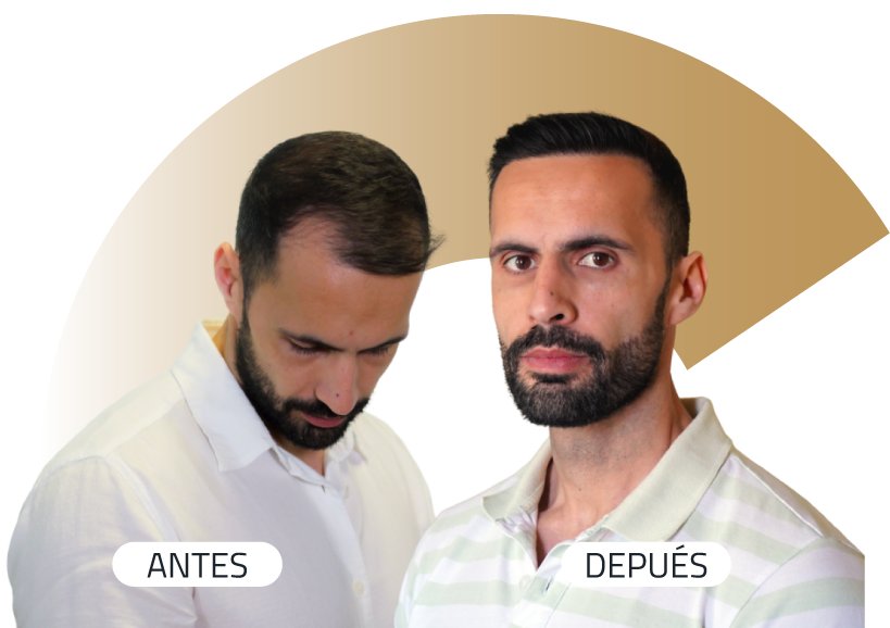 Insparya Antes / Después