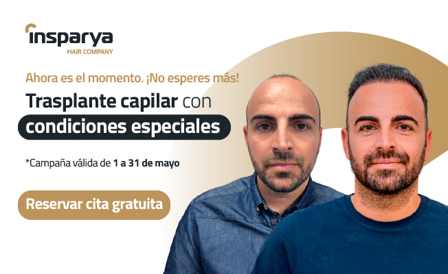 Transplante Capilar con condiciones especiales . Reservar cita gratuita