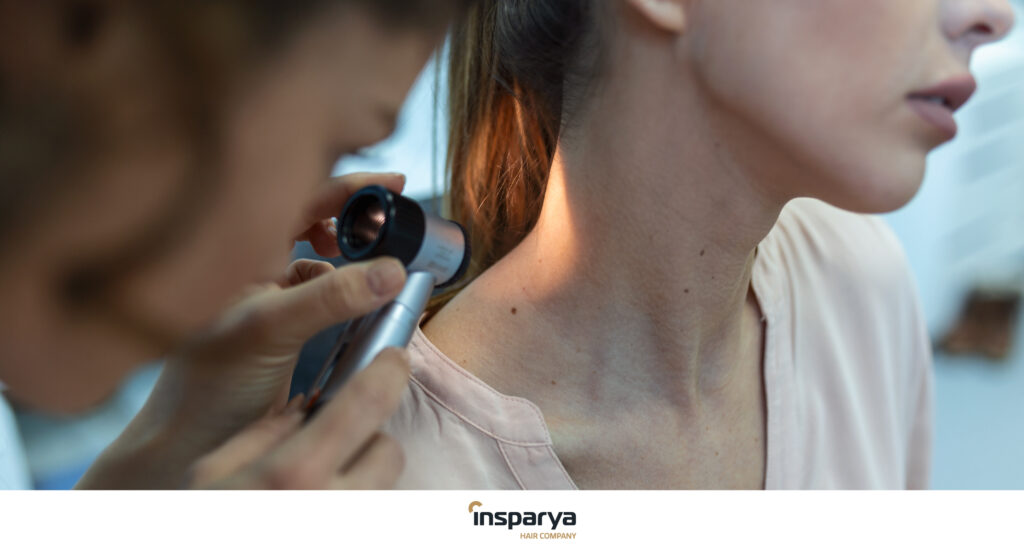 Melanoma en el cuero cabelludo: señales de alerta, prevención e impacto en la salud capilar