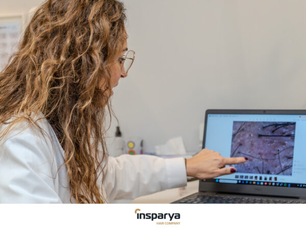 Tratamientos preventivos vs. trasplante capilar: ¿cuál es la mejor opción para tu pelo? 