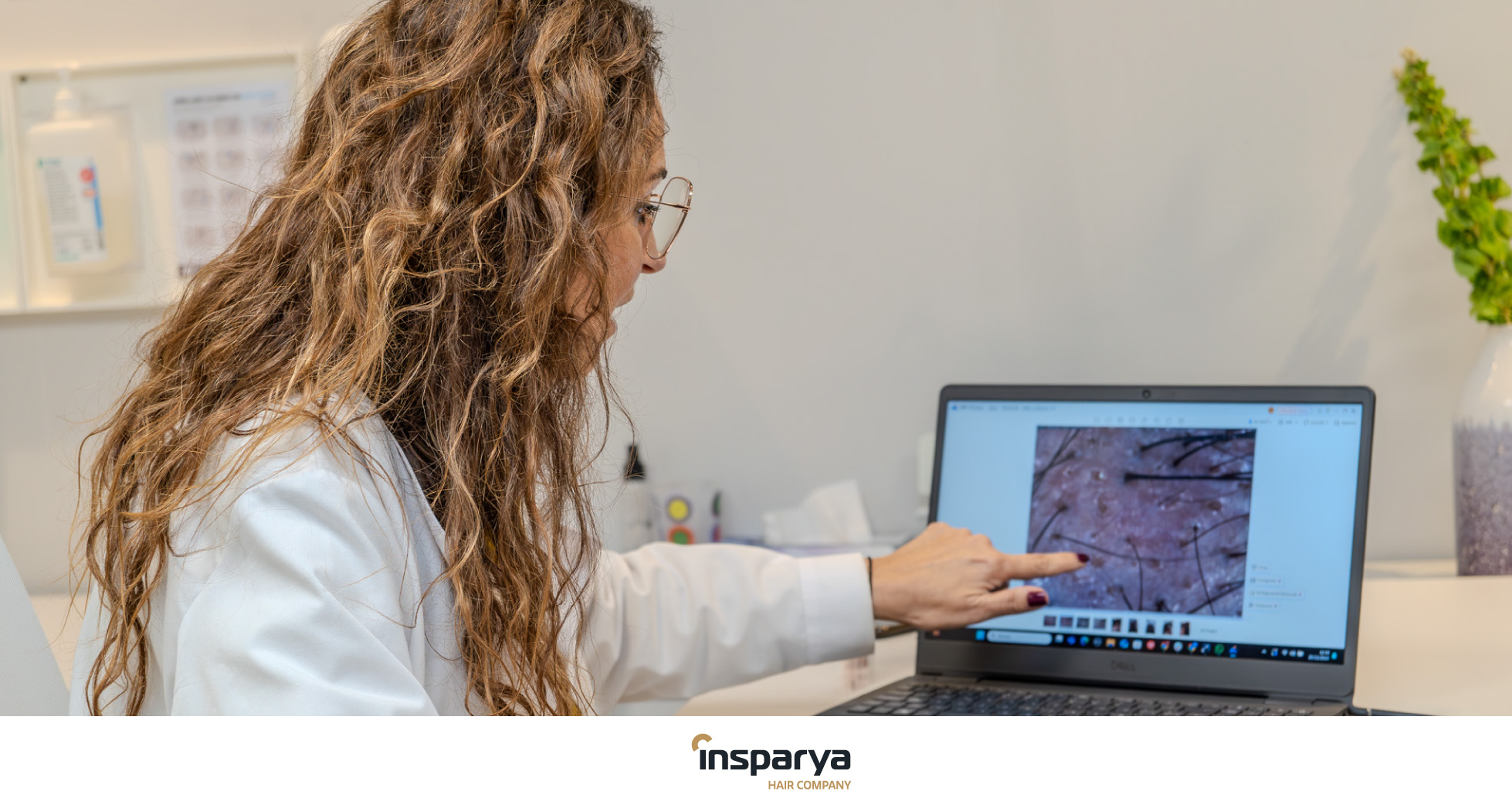 Tratamientos preventivos vs. trasplante capilar: ¿cuál es la mejor opción para tu pelo? Tratamientos preventivos vs. trasplante capilar: ¿cuál es la mejor opción para tu pelo?